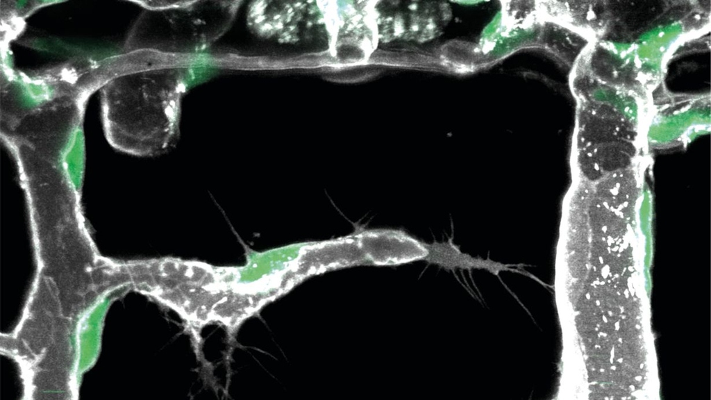 Microscopic view of cell walls with green highlights on a dark background.